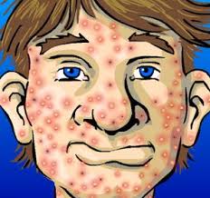 how an acne covered face looks like